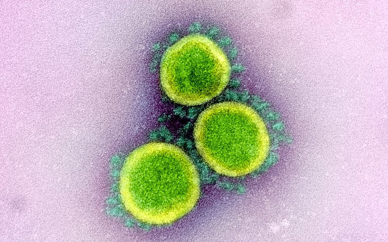 SARS-CoV-2 real - coronavirus